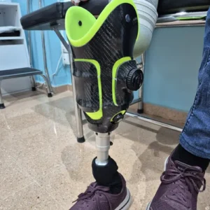 PRÓTESIS TIBIALES